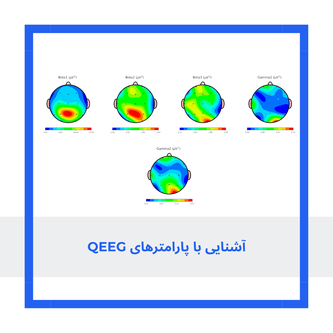 آشنایی با پارامترهای QEEG یا نقشه مغز