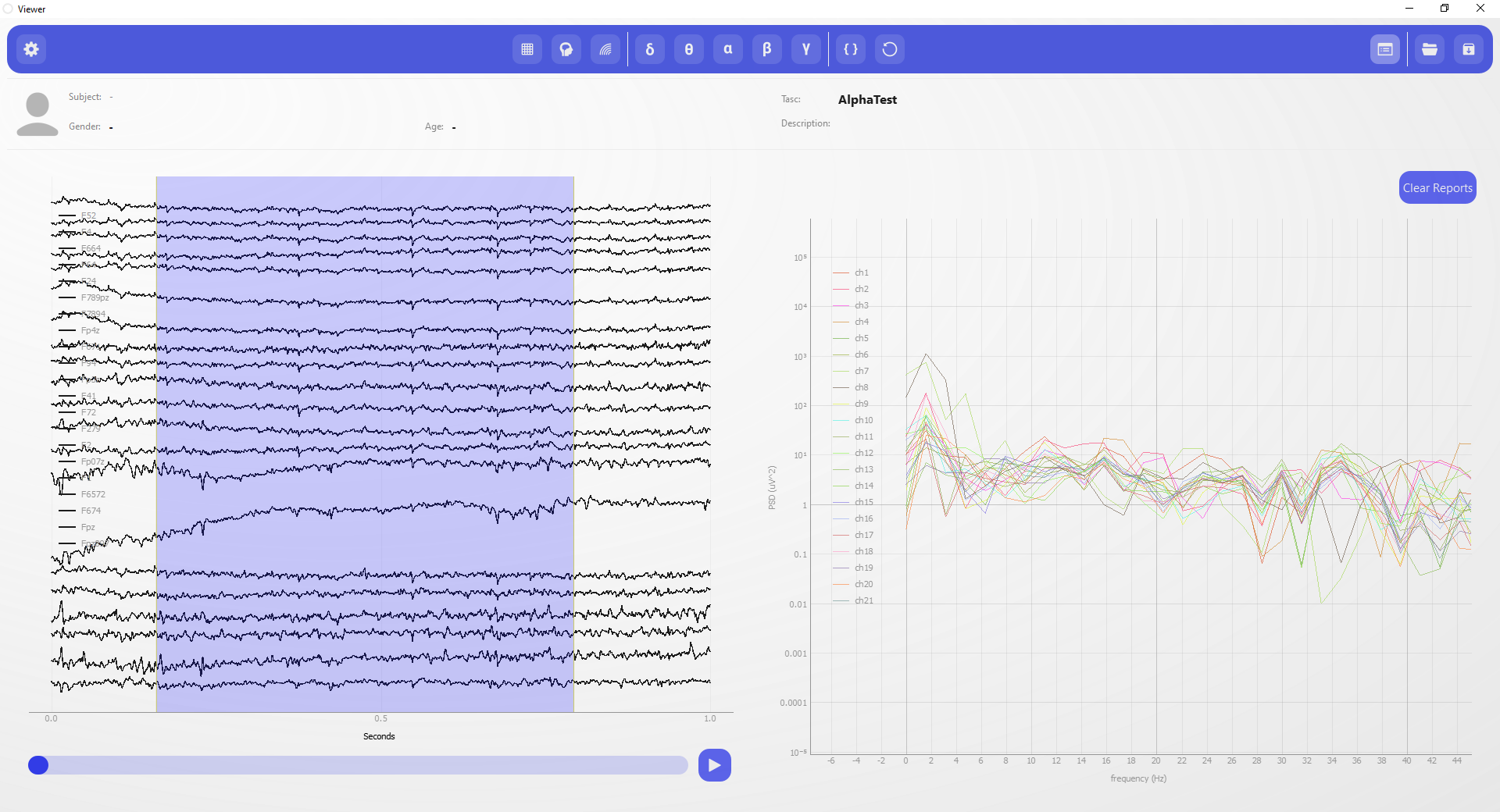 sarmadtec Sarmad tec خرید دستگاه EEG نقشه مغزی QEEG دستگاه نوروفیدبک خرید دستگاه نوروفیدبک دستگاه QEEG دستگاه روانپزشکی تشخیص ADHD تشخیص autism تشخیص اتیسم EEG