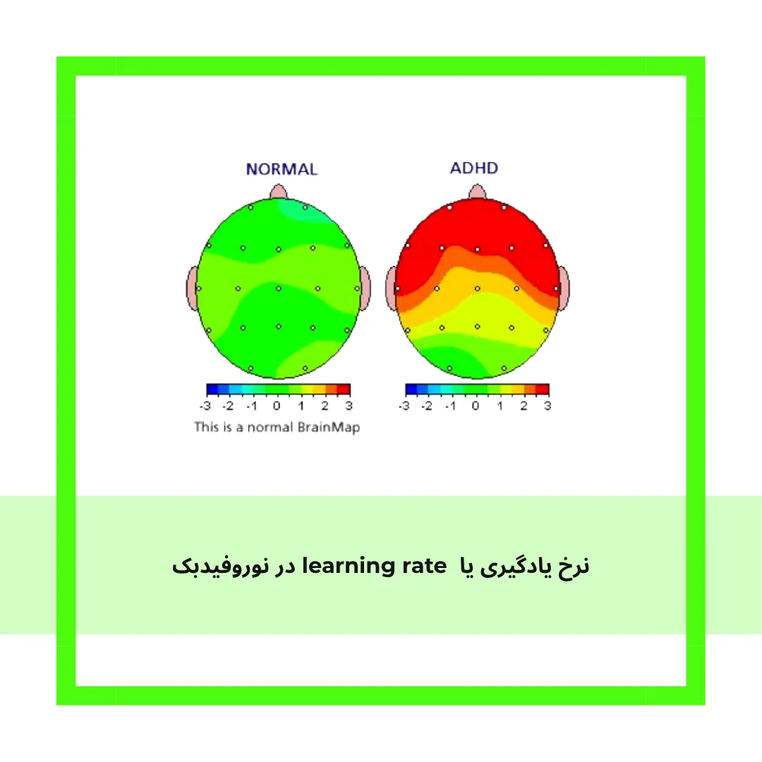 تحلیل گزارش مغز و نوروفیدبک